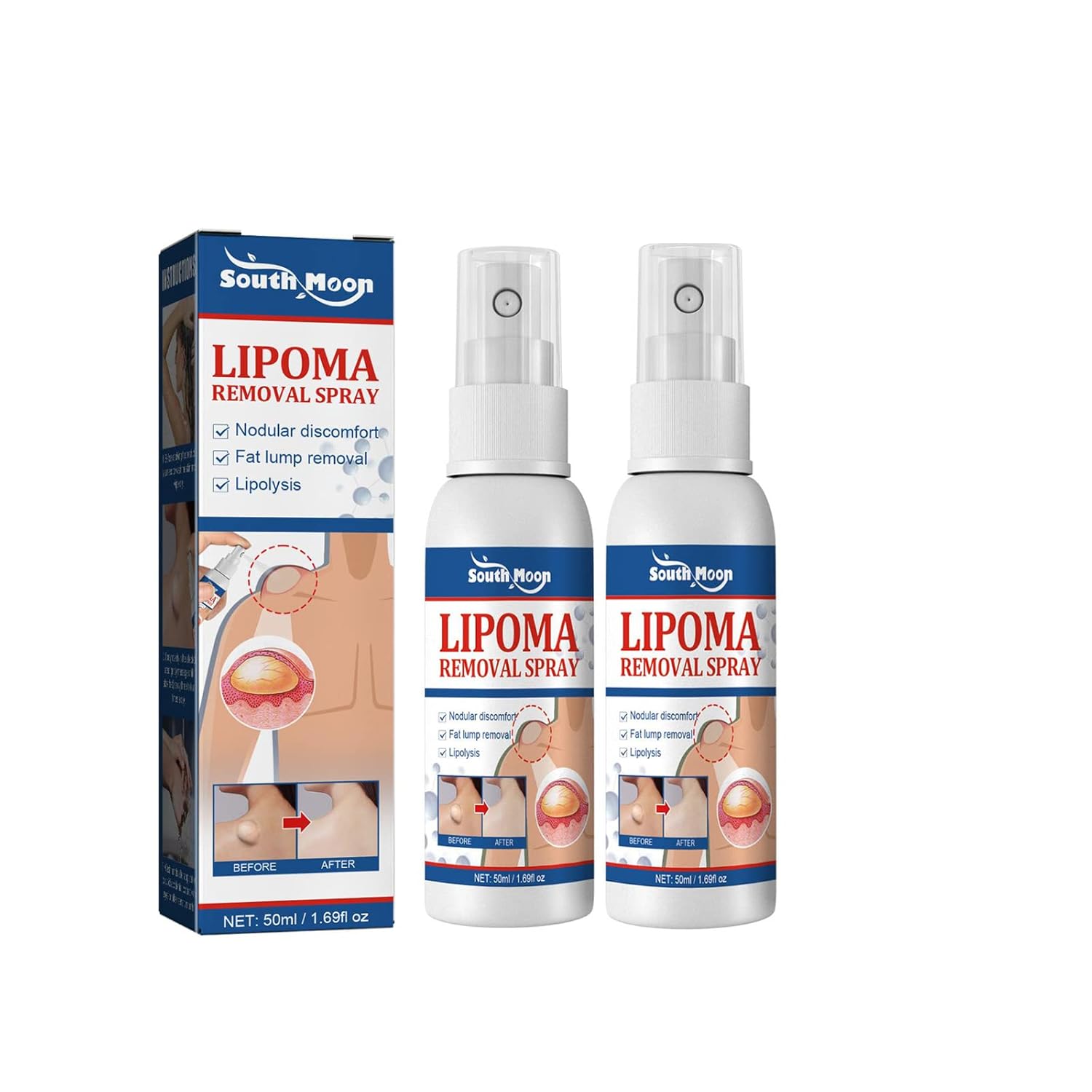 Spray Eliminacion Lipoma X2